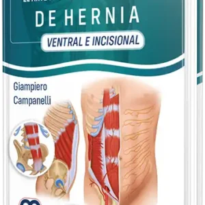 El arte de la Cirugía de la Hernia - Ventral e Incisional
