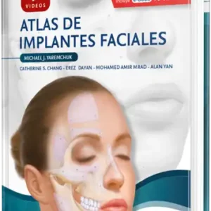 Atlas de implantes faciales
