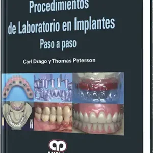 Procedimientos de Laboratorio en Implantes Paso a Paso.
