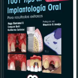 1001 Tips en Implantología Oral