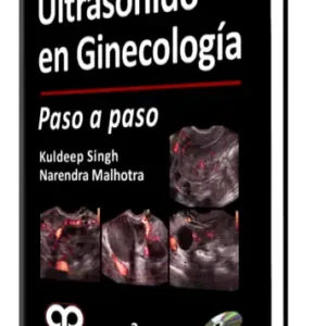 Ultrasonido en Ginecología Paso a paso. 2 Edición