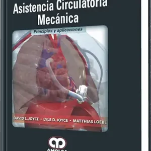 Asistencia Circulatoria Mecánica
