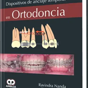 Dispositivos de Anclaje Temporal en Ortodoncia