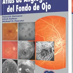 Atlas de Angiografía del Fondo de Ojo