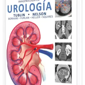Imagenología en Urología