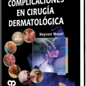 Complicaciones en Cirugía Dermatológica