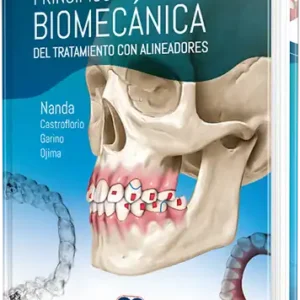 Principios y biomecánica del tratamiento con alineadores