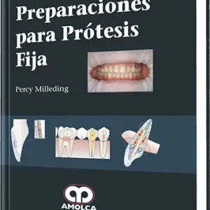 Preparaciones para Prótesis Fija