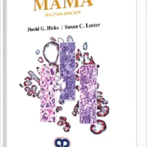 Diagnóstico Patológico Mama. 2 Edición
