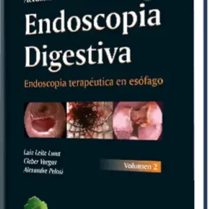 Actualización en Endoscopia Digestiva. Endoscopia Terapéutica en Esófago Volumen 2