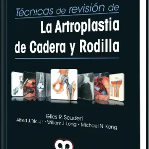 La Artroplastia de Cadera y Rodilla