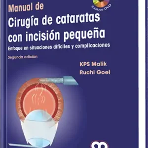 Manual de Cirugía de Cataratas con Incisión Pequeña. 2 Edición