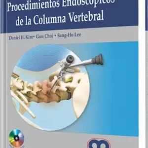 Procedimientos Endoscópicos de la Columna Vertebral