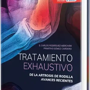 Tratamiento exhaustivo de la artrosis de rodilla