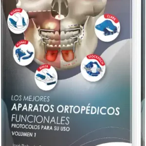 Los Mejores Aparatos Ortopédicos Funcionales. Protocolos para su uso. Volumen 1