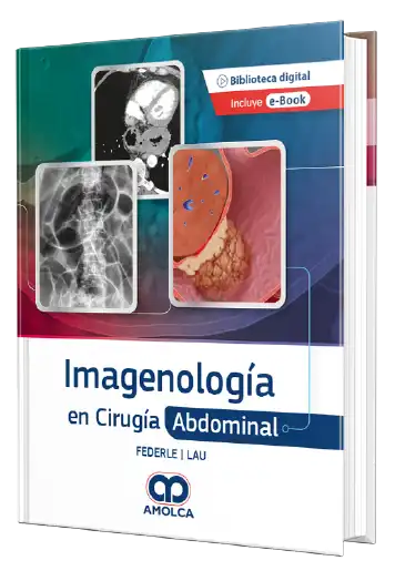 Imagenología en Cirugía Abdominal