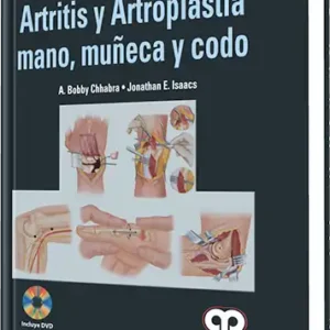 Artritis y Artroplastia - Mano, Muñeca y Codo