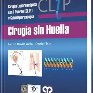 Cirugía sin Huella