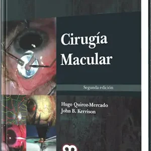 Cirugía Macular. 2 Edición