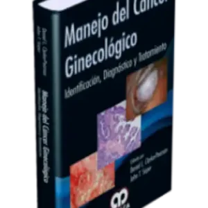 Manejo del Cáncer Ginecológico