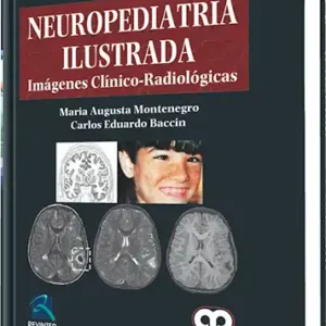 Neuropediatría Ilustrada