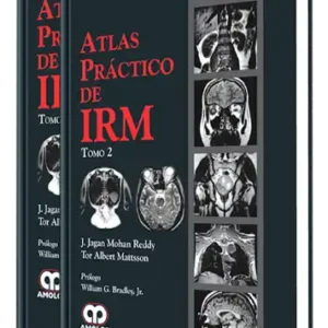 Atlas Práctico de IRM