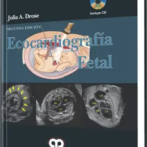 Ecocardiografía Fetal 2 Edición