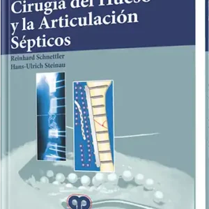 Cirugía del Hueso y la Articulación Sépticos