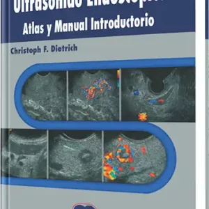 Ultrasonido Endoscópico