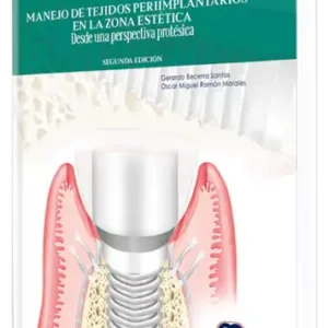 Manejo de Tejidos Periimplantarios en la Zona Estética. Desde una Perspectiva Protésica. 2 edición