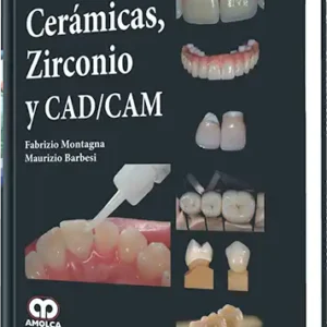 Cerámicas, Zirconio y CAD/CAM