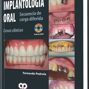 Implantología Oral