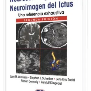 Neurosonología y Neuroimagen del Ictus una Referencia Exhaustiva.  2 Edición