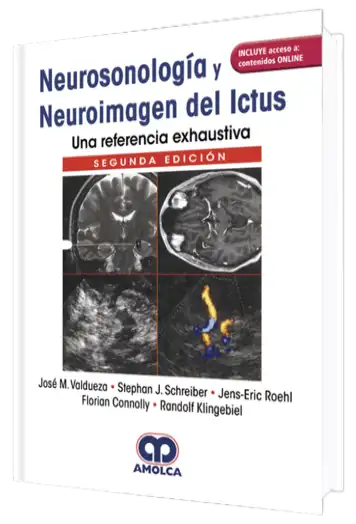 Neurosonología y Neuroimagen del Ictus una Referencia Exhaustiva. 2 Edición