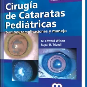 Cirugía de Cataratas Pediátricas. 2 Edición