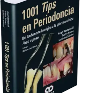 1001 Tips en Periodoncia