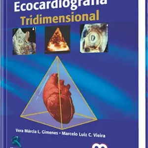 Ecocardiografía Tridimensional