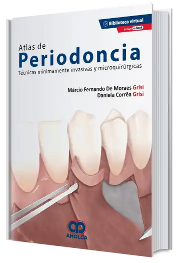 Atlas de Periodoncia