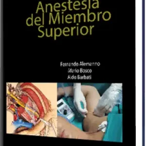 Anestesia del Miembro Superior