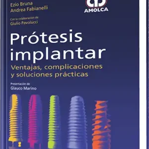 Prótesis Implantar