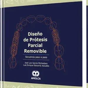 Diseño de Prótesis Parcial Removible