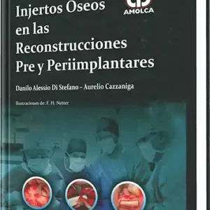 Injertos Óseos en las Reconstrucciones Pre y Periimplantares