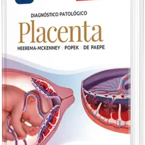 Diagnóstico patológico: Placenta. 2a Edición