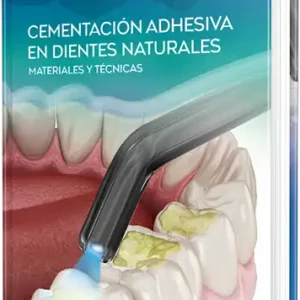 Cementación adhesiva en dientes naturales. Materiales y técnicas