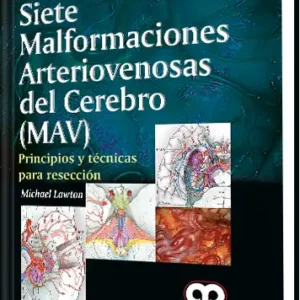 Siete Malformaciones Arteriovenosas del Cerebro (MAV)