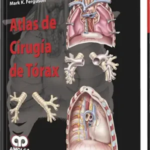 Atlas de Cirugía de Tórax