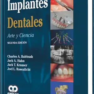 Implantes Dentales. Arte y Ciencia. 2 Edición