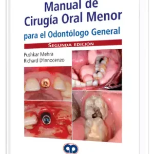 Manual de Cirugía Oral Menor para el Odontólogo General. 2 Edición