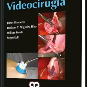 Videocirugía