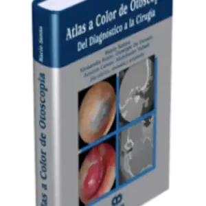 Atlas a Color de Otoscopia